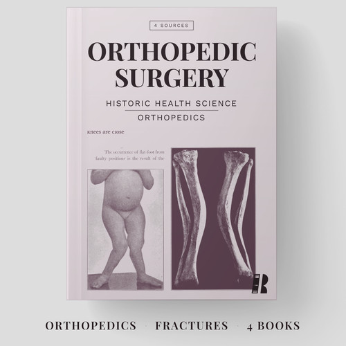 Orthopedic surgery fractures - orthopedic, surgery,